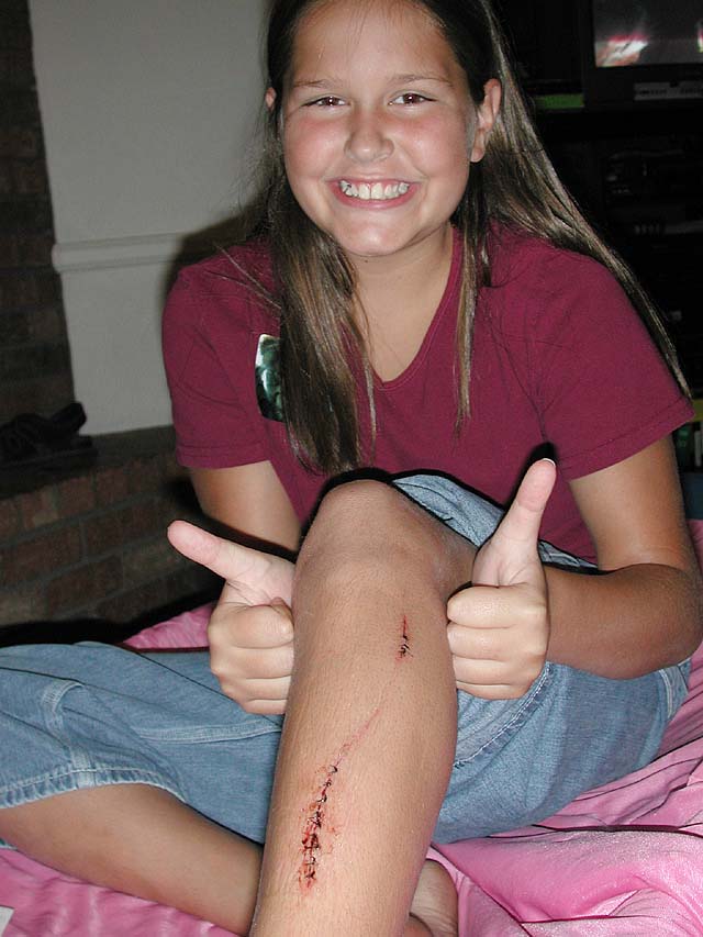 becca_leg