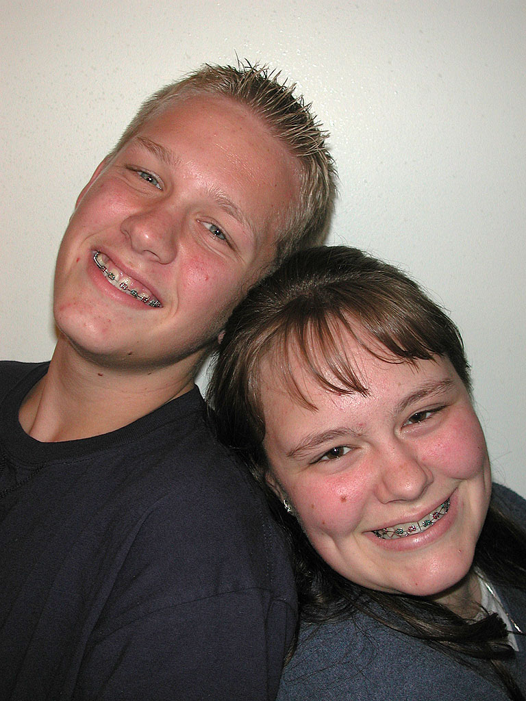 brace-faces