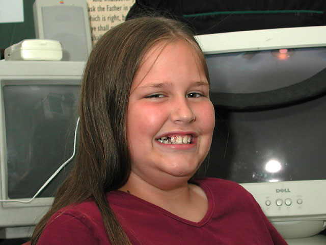 rebecca_new_tooth_gap
